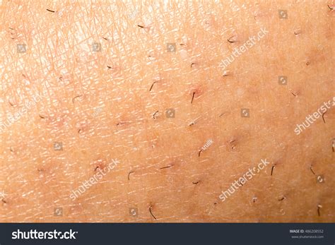Hairs On The Skin Of The Female Leg Stock Photo 486208552 Shutterstock