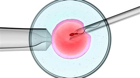 What Is Intracytoplasmic Sperm Injection Icsi Inovi Fertility Genetics