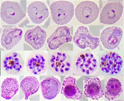 What Are Malaria Parasites Hiding In Their Genes? | Genetics And Genomics