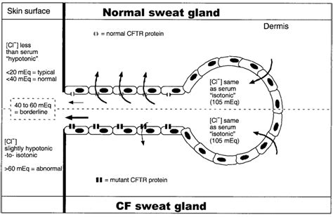 Diagram Of A Sweat Gland Showing Paths Taken By Chloride Ions Arrows