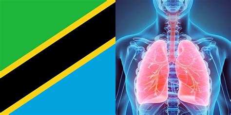 Lung Disease In Tanzania