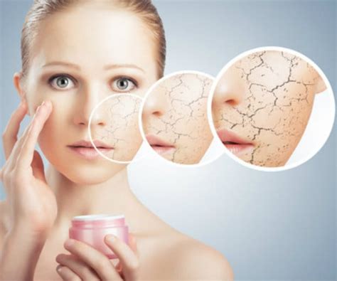 Fighting Dry Skin How To Beat The Itch Of Winter