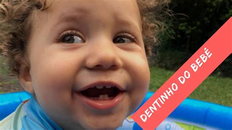 Cuidados Com Os Dentinhos De Leite Do Bebê Dentinho Dentição