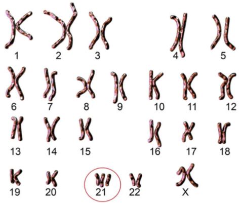 While Studying Karyotypes A Student Had Drawn The Karyotypes Of Two