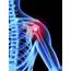 Shoulder Pain Relief  Tips From Ottawa Orleans Chiropractor