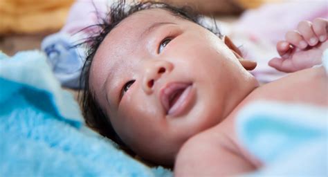 What To Do If Your Baby Has A Swollen Eye Babycenter