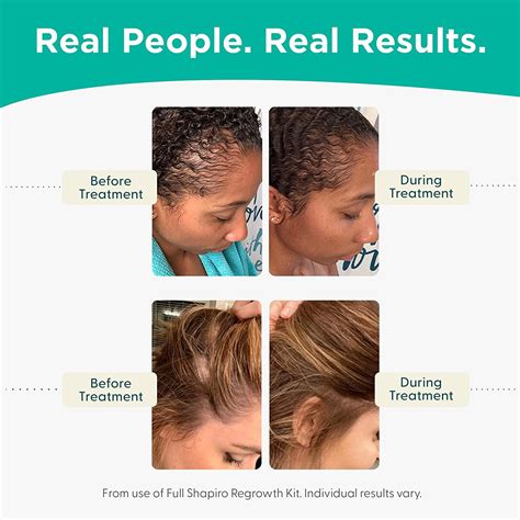 Minoxidil 2% Women's Hair Growth Serum | Promotes Hair Regrowth