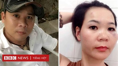 Bà Lê Mỹ Hạnh Làm Việc Với Công An Vì Bị Hành Hung Bbc News Tiếng Việt