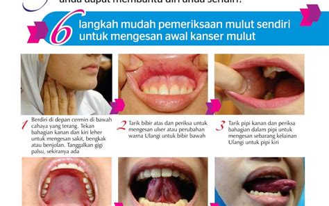 General Oral Health Care Malaysian Dental Association