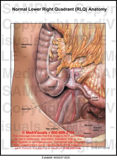 Because you have a tight muscle in your back causing these things to happen. Medivisuals Normal Lower Right Quadrant (RLQ) Anatomy ...