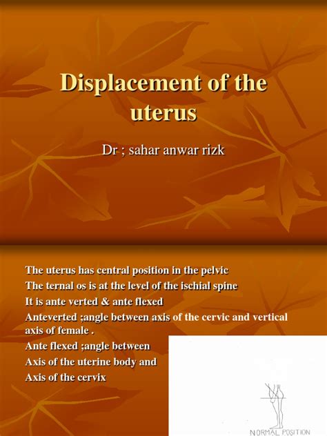 Displacement Of The Uterus Uterus Vagina
