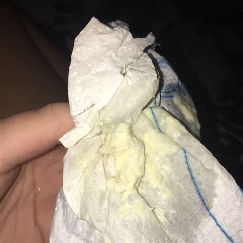 Yeast Infection Discharge Yellow