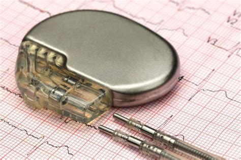 Living With A Pacemaker Health And Detox And Vitamins