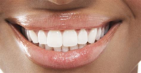 One Easy And Cheap Way To Achieve Whiter Teeth Love Resee One Easy
