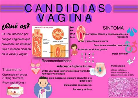 Candidiasis Vaginal Salud Candidiasis Udocz