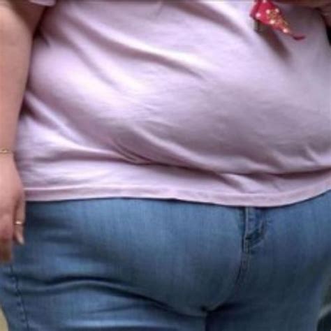 Should Obese People Be Provided With The Same Access To Treatment As Others Obese People Should