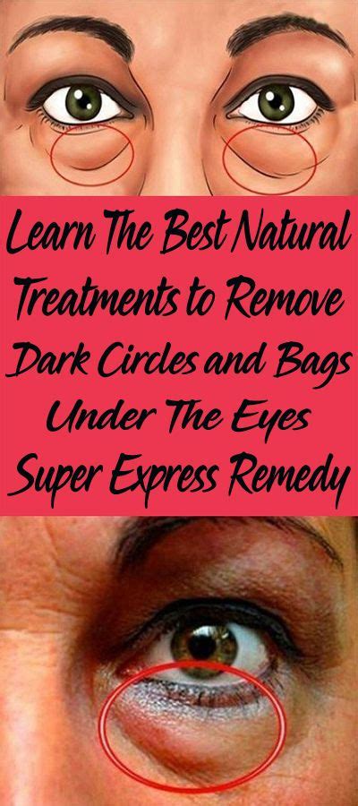 It is the most 9. Learn The Best Natural Treatments to Remove Dark Circles ...