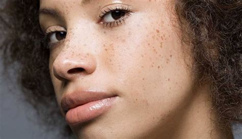 Parameter air yang tepat, hal makanan tepat, untuk membantu ikan discus menghilangkan bintik hitamnya sendiri secara perlahan adalah dengan memberikan makanan yang. Bosan Freckles, Ini Cara Mudah dan Murah Hilangkan Bintik ...