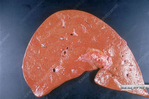 Liver Stock Image C0034271 Science Photo Library