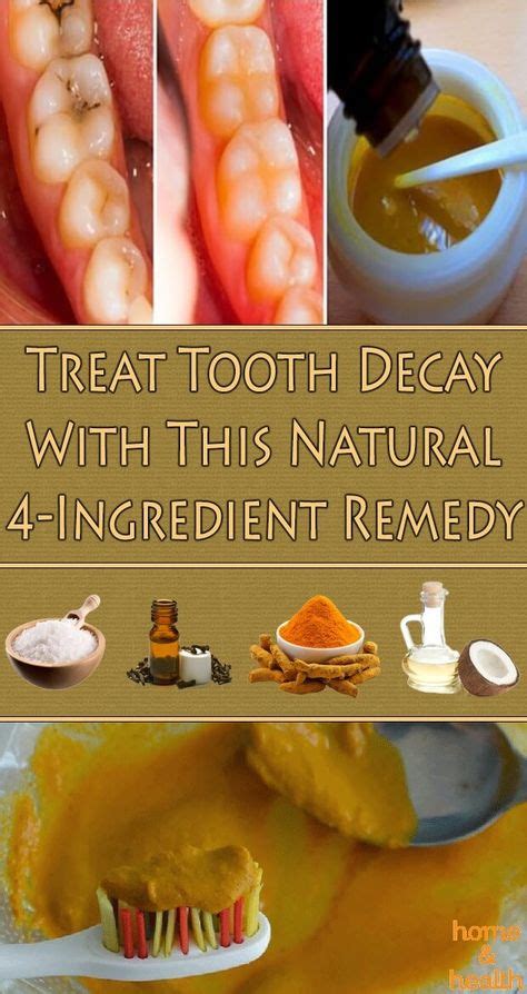 Treat Tooth Decay With This Natural 4 Ingredient Remedy Tooth Decay