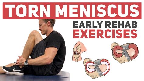 Meniscus Tear Start With These Rehab Exercises Youtube