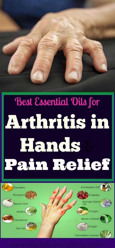 Pin On Arthritis Remedies