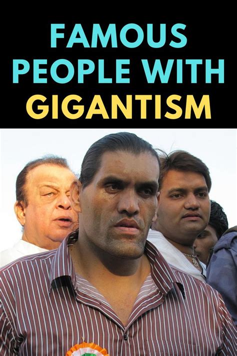 Famous People With Gigantism | Famous people, List of famous people, Famous