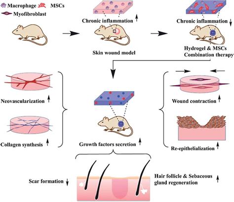 Fig 5 Msc Laden Hydrogels Can Prohibit Chronic Inflammation And