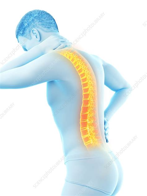 Back Pain Conceptual Illustration Stock Image F0257798 Science