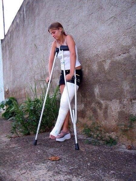 Llc Long Leg Cast White Crutches 53e