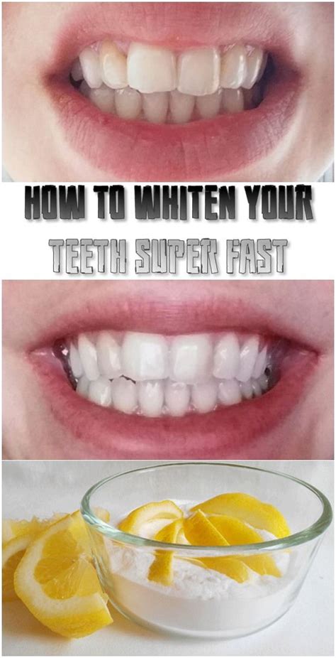 How To Whiten Your Teeth Super Fast Fitness Shortcut