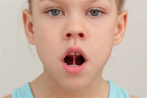 7500 Soft Palate Stock Photos Pictures And Royalty Free Images Istock