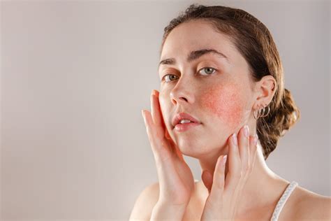 Sensitive Skin Obagi Medical