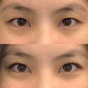 Free 35 Eyelash Extensions Before And After Asian