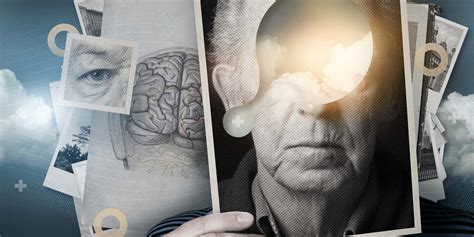 But many of the diseases that cause dementia aren't curable. Recognising and managing early dementia - bpacnz