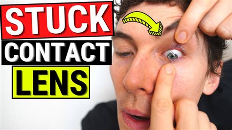 How To Remove A STUCK Contact Lens From The Eye YouTube