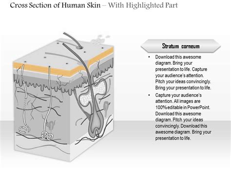 0614 Cross Section Of Human Skin Medical Images For Powerpoint