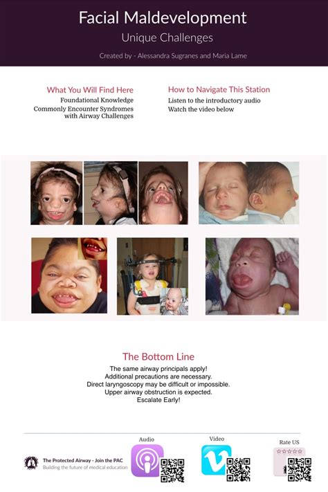 Facial Maldevelopment And The Pediatric Airway The Protected Airway
