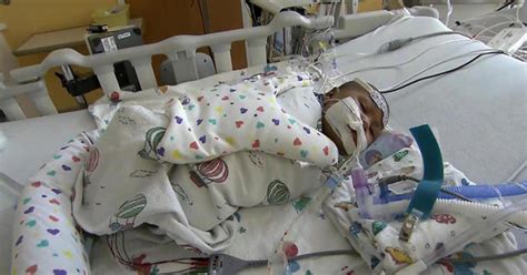 Hospitals See Rise In Babies With Respiratory Illness Rsv Cbs News