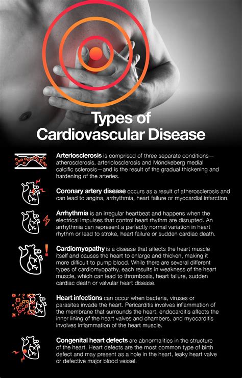 Cardiovascular Diseases Types Symptoms Causes Treatme