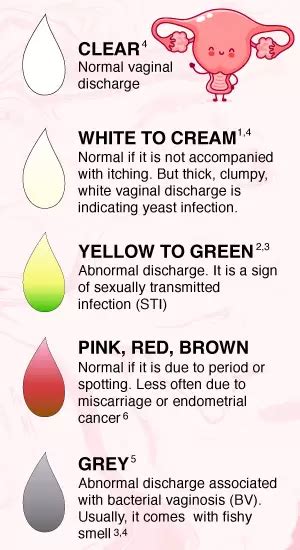 Vaginal Discharge Normal Vs Not Normal