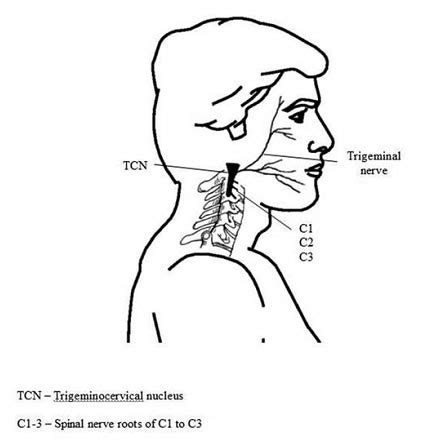 Para responder a esta pregunta antes tenemos que tener claros algunos. Cefalea cervicogénica. Revisión bibliográfica
