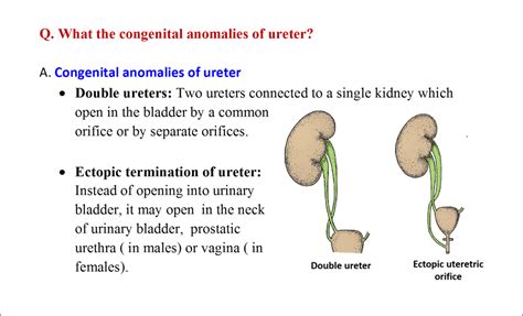 Development of Kidney and Ureter - Anatomy QA