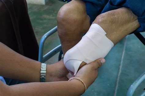 Man Amputates Own Leg With A Pocket Knife Following Farm Accident