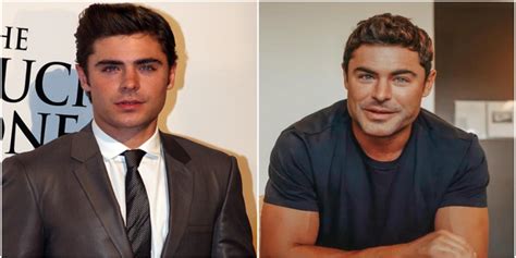 the real reason for zac efron new face was revealed by dr anthony youn