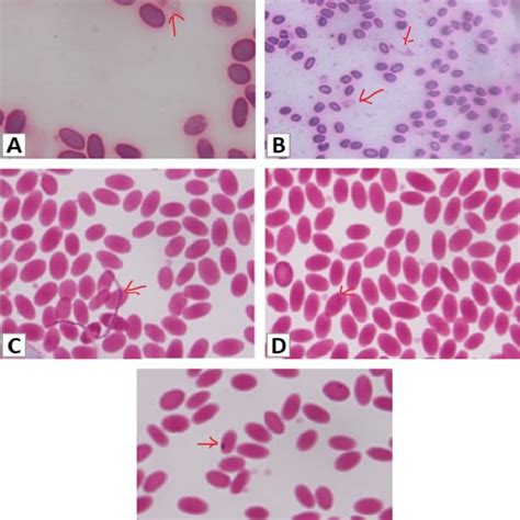 Blood Smear Of Camels Showing Haemoparasites A And B Trypanosoma