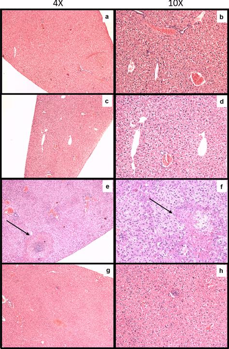 Photomicrographs Of The Liver Of Mice Showing Histopathological
