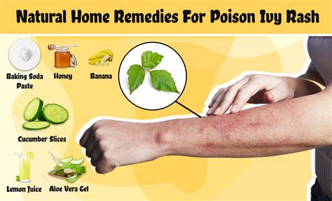 How To Get Rid Of Poison Ivy Rash At Home