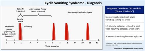 Cyclic Vomiting Syndrome Diagnosis Diagnostic Criteria Grepmed