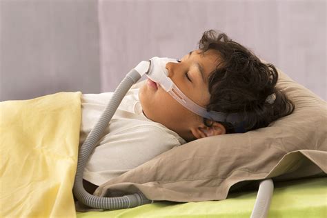 Obstructive Sleep Apnea Pediatric Diagnostic Challenges Mcg Health